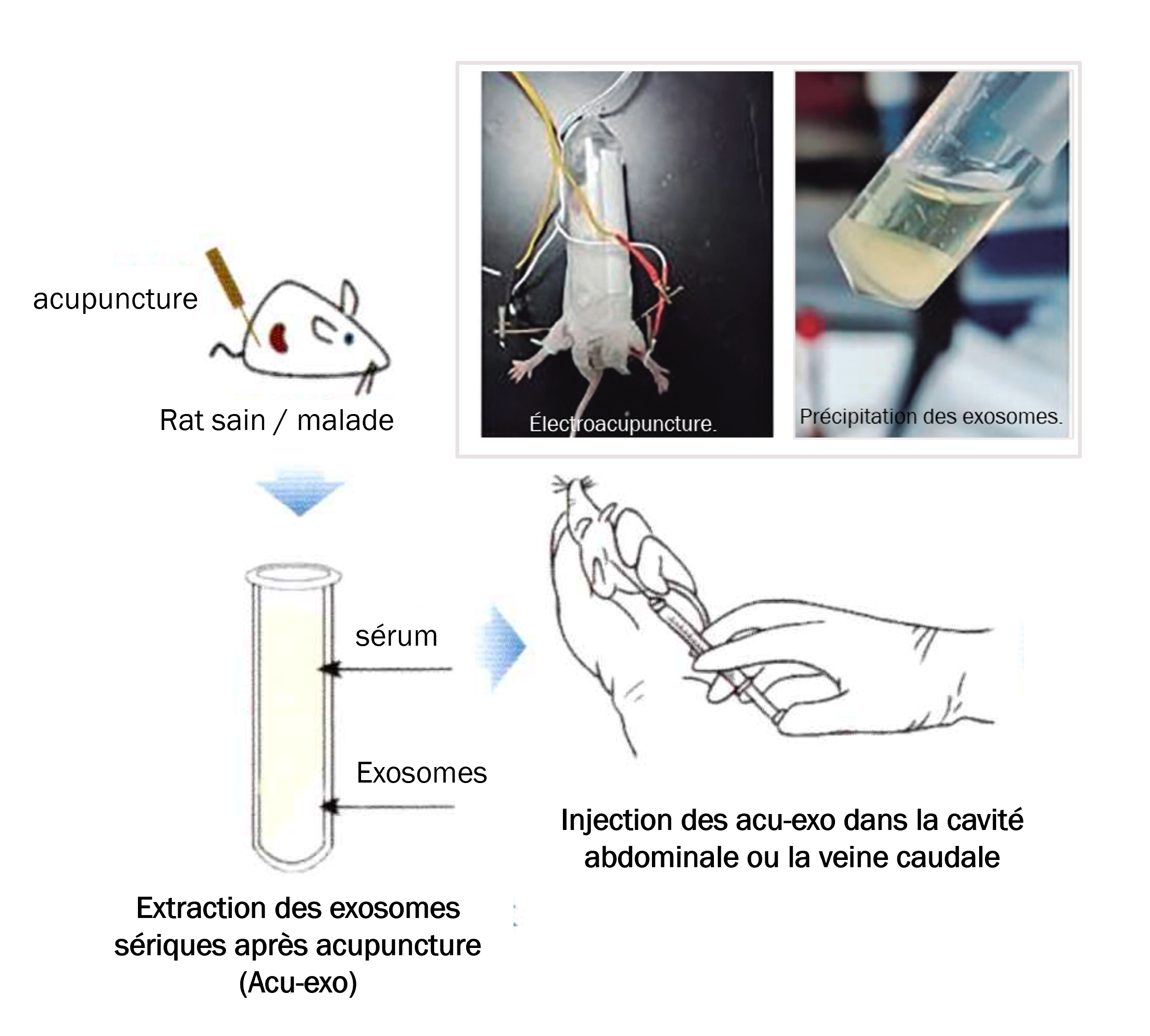 Méthode de transfert des acu-exo