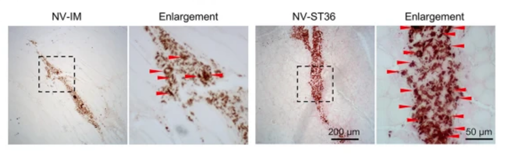 Activation mastocytaire