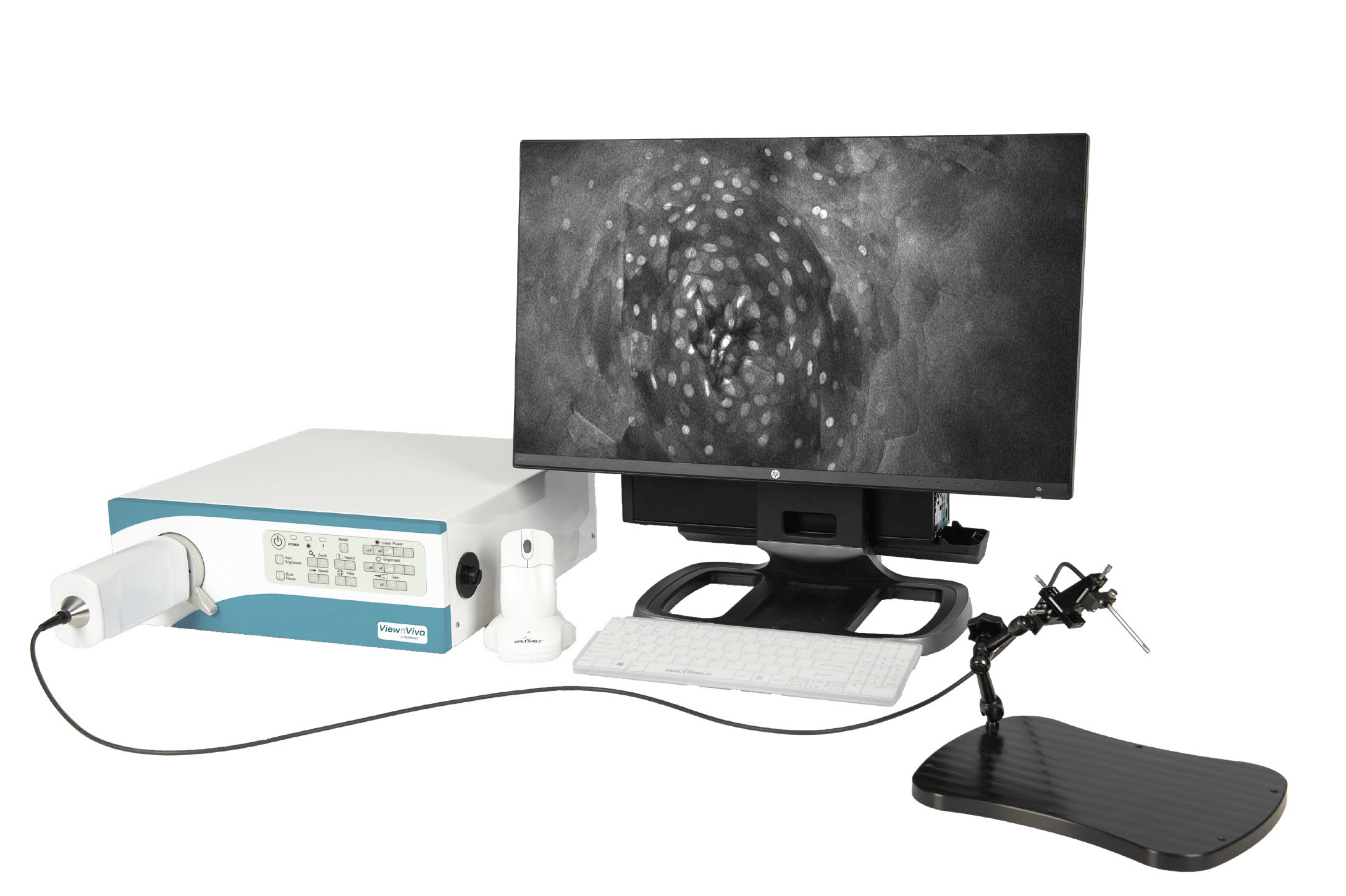 Appareil d’imagerie confocale in vivo Optiscan ViewnVivo B30