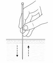 Schéma illustrant le mouvement d'enfoncement et de retrait de l'aiguille